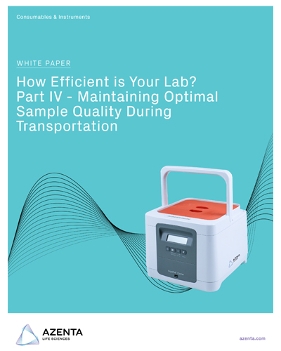 How Efficient Is Your Lab? Sample Quality During Transportation