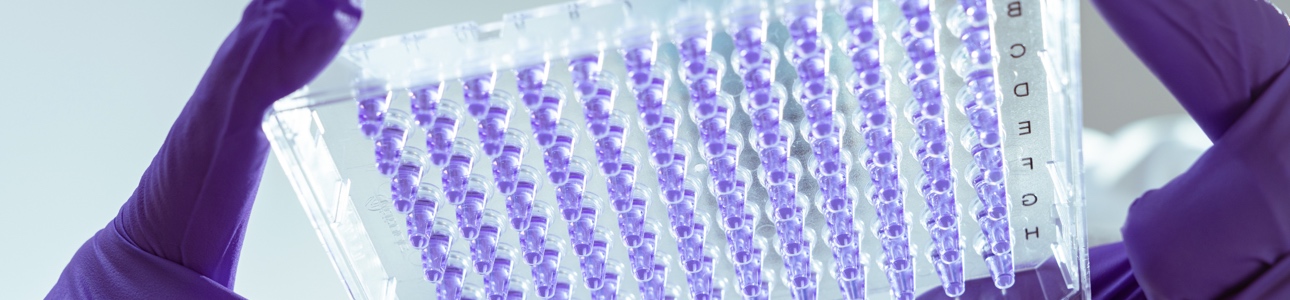 Microplate with reagent being inspected