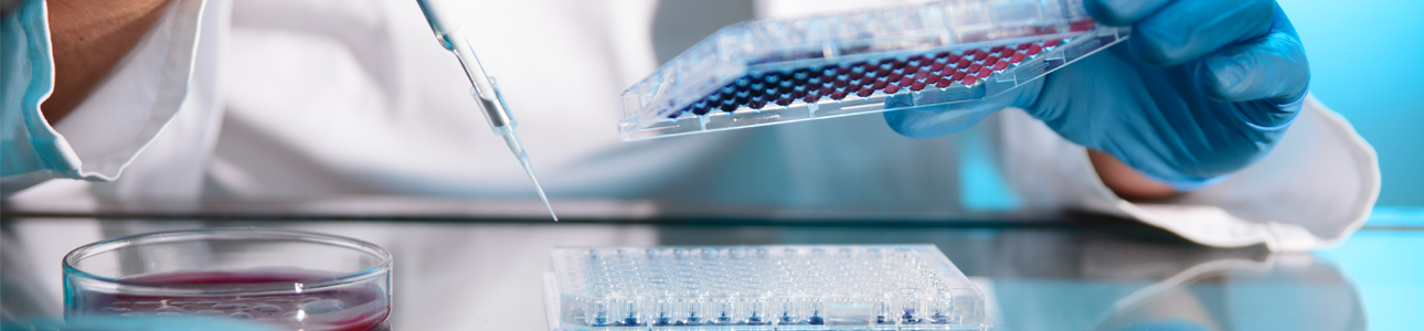 Lab technician pipetting samples in microplate