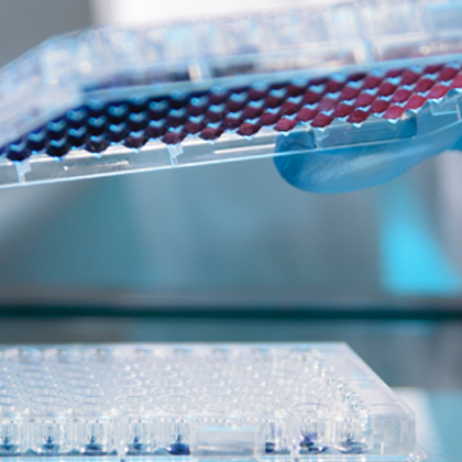 Lab technician pipetting samples in microplate